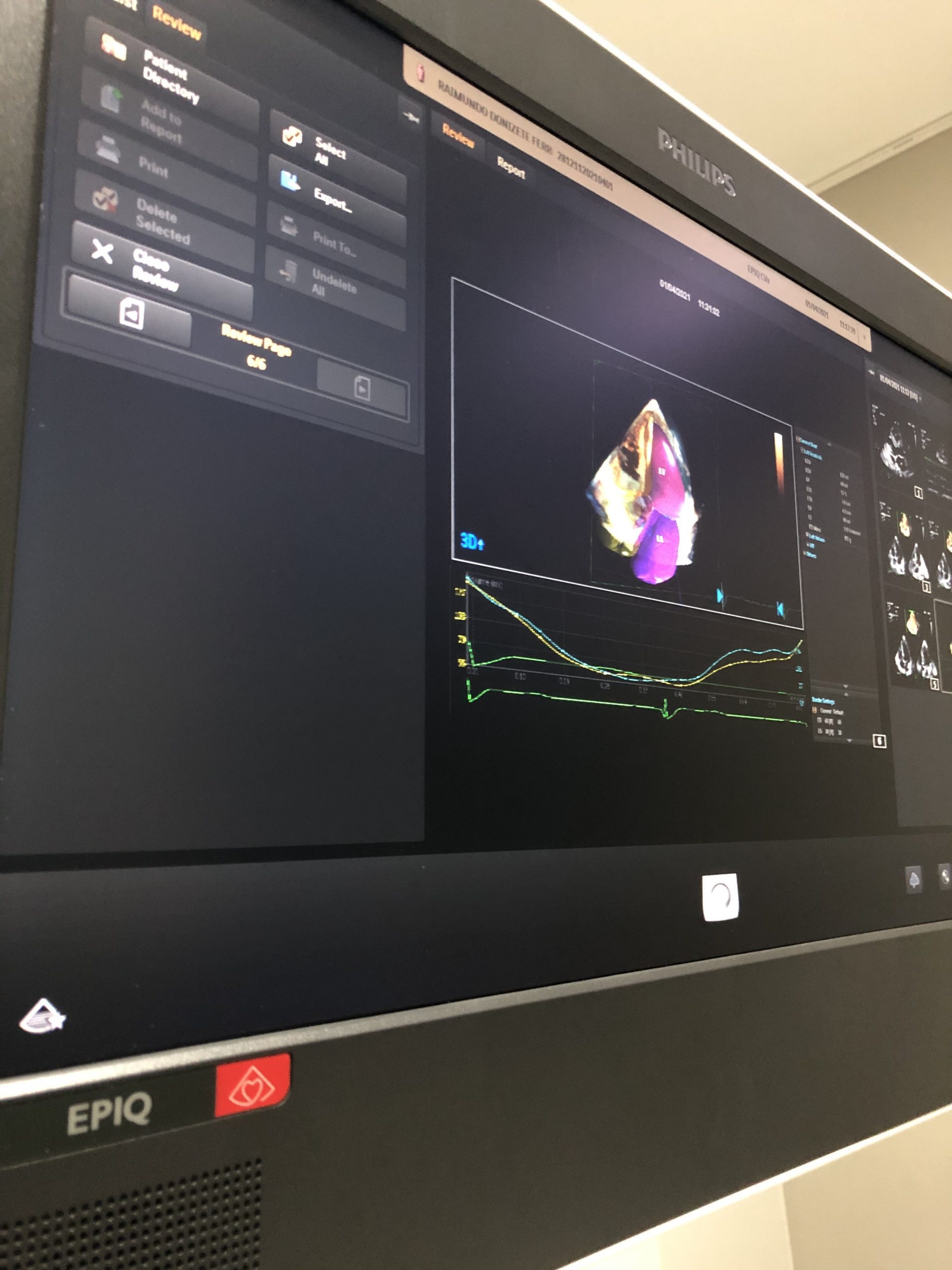 Exame ECO Min Scaled, Clinicor BD