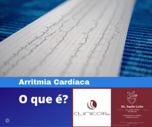 Arritmia Cardiaca 300x251, Clinicor BD